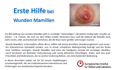 Premiers soins pour les mamelons douloureux - dépliant (allemand; EISL)